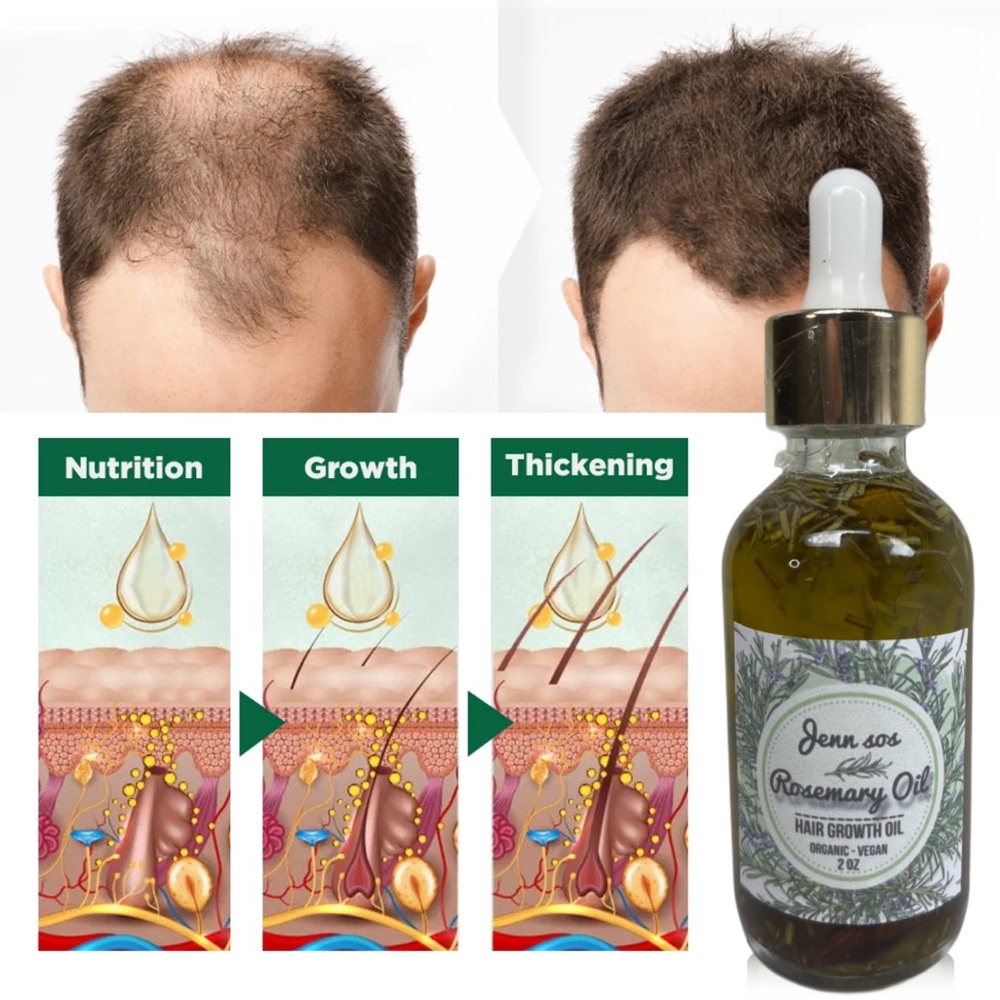 Rosemary oil for hair growth, anti hair loss dropper